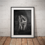 Unhappy Triad Knie - Chalkboard - Animus Medicus GmbH