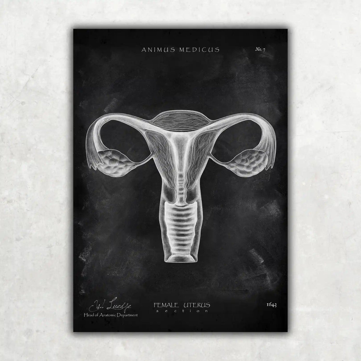Uterus Anatomie - Chalkboard - Animus Medicus GmbH