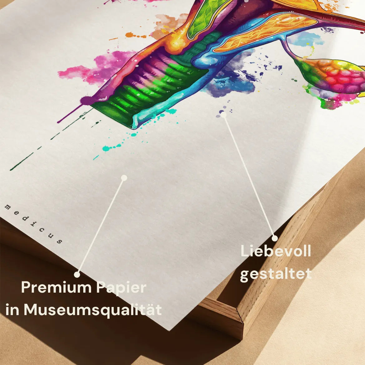 Uterus Anatomie - Rainbow - Animus Medicus GmbH