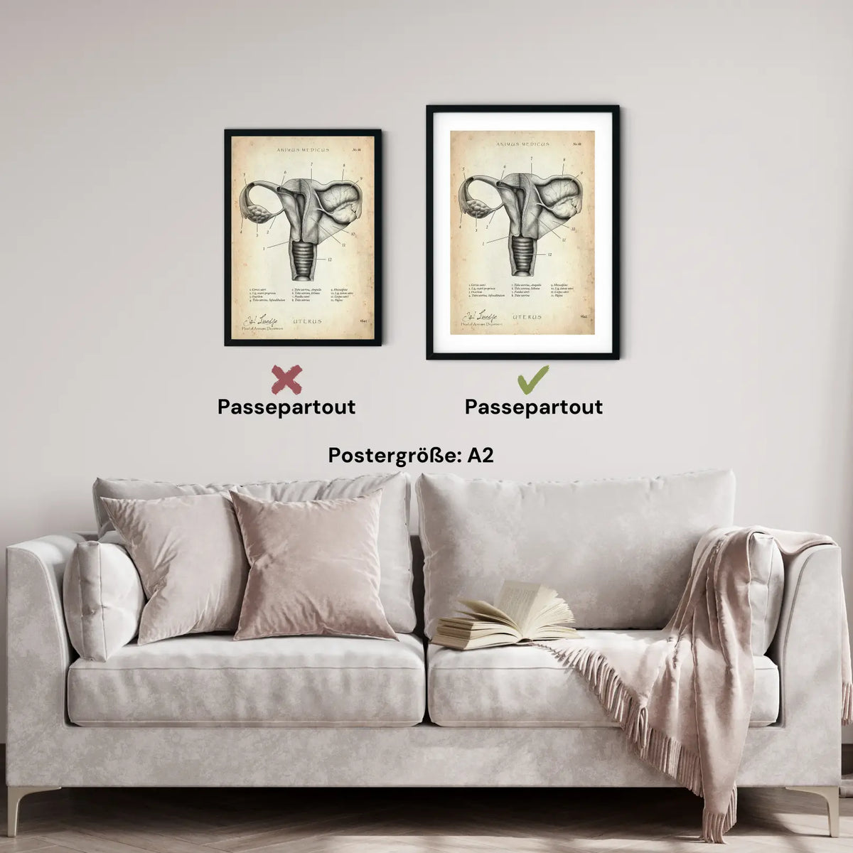 Uterus mit Adnexe - Animus Medicus GmbH