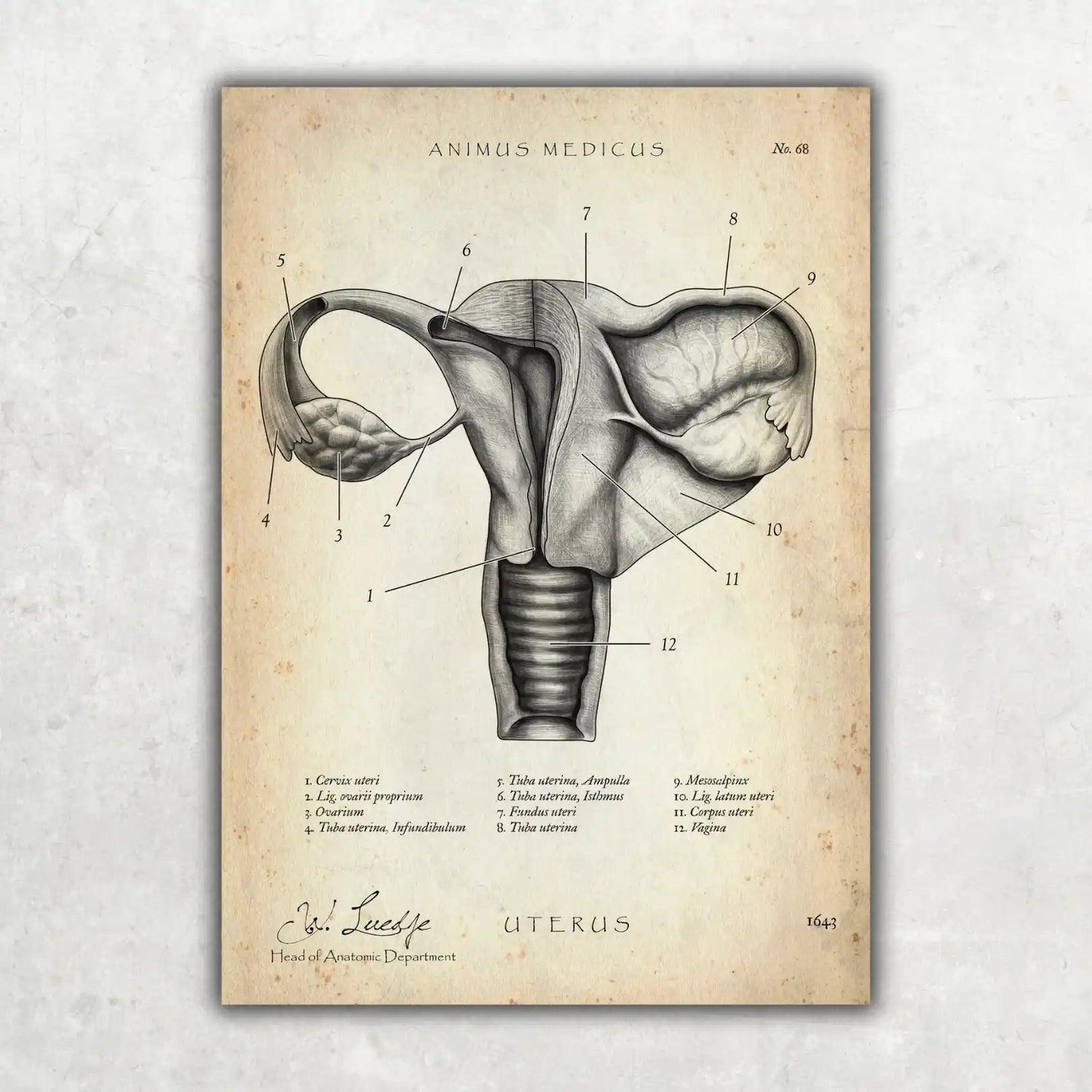 Uterus mit Adnexe - Animus Medicus GmbH