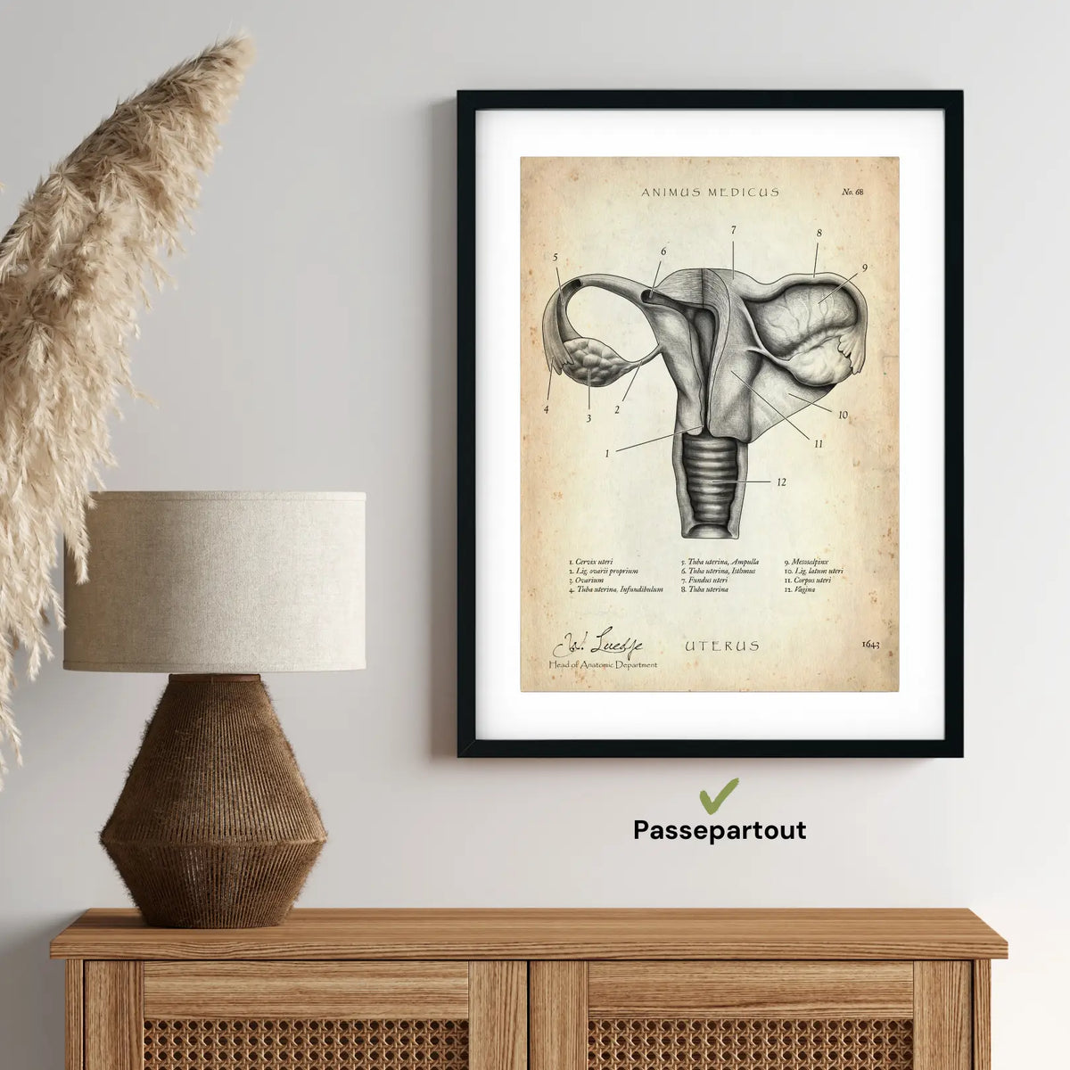 Uterus mit Adnexe - Animus Medicus GmbH