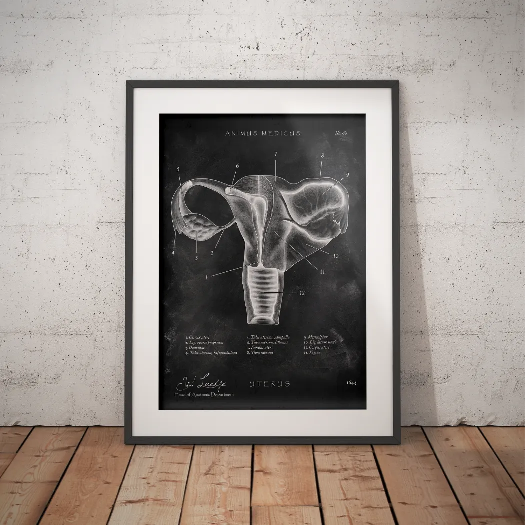 Uterus mit Adnexe - Chalkboard - Animus Medicus GmbH
