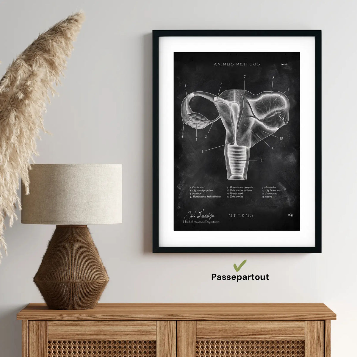 Uterus mit Adnexe - Chalkboard - Animus Medicus GmbH