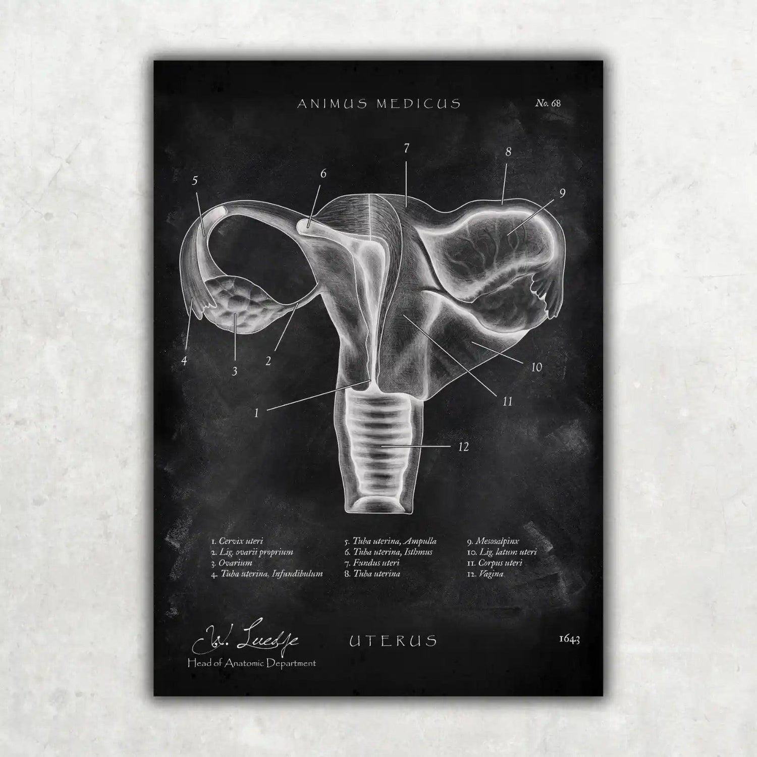 Uterus mit Adnexe - Chalkboard - Animus Medicus GmbH