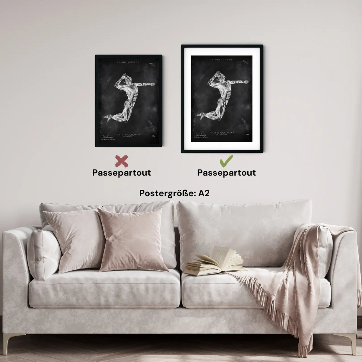 Volleyball Anatomie Poster - Chalkboard - Animus Medicus GmbH