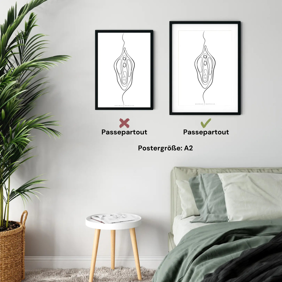Vulva Anatomie Minimalist - Animus Medicus GmbH