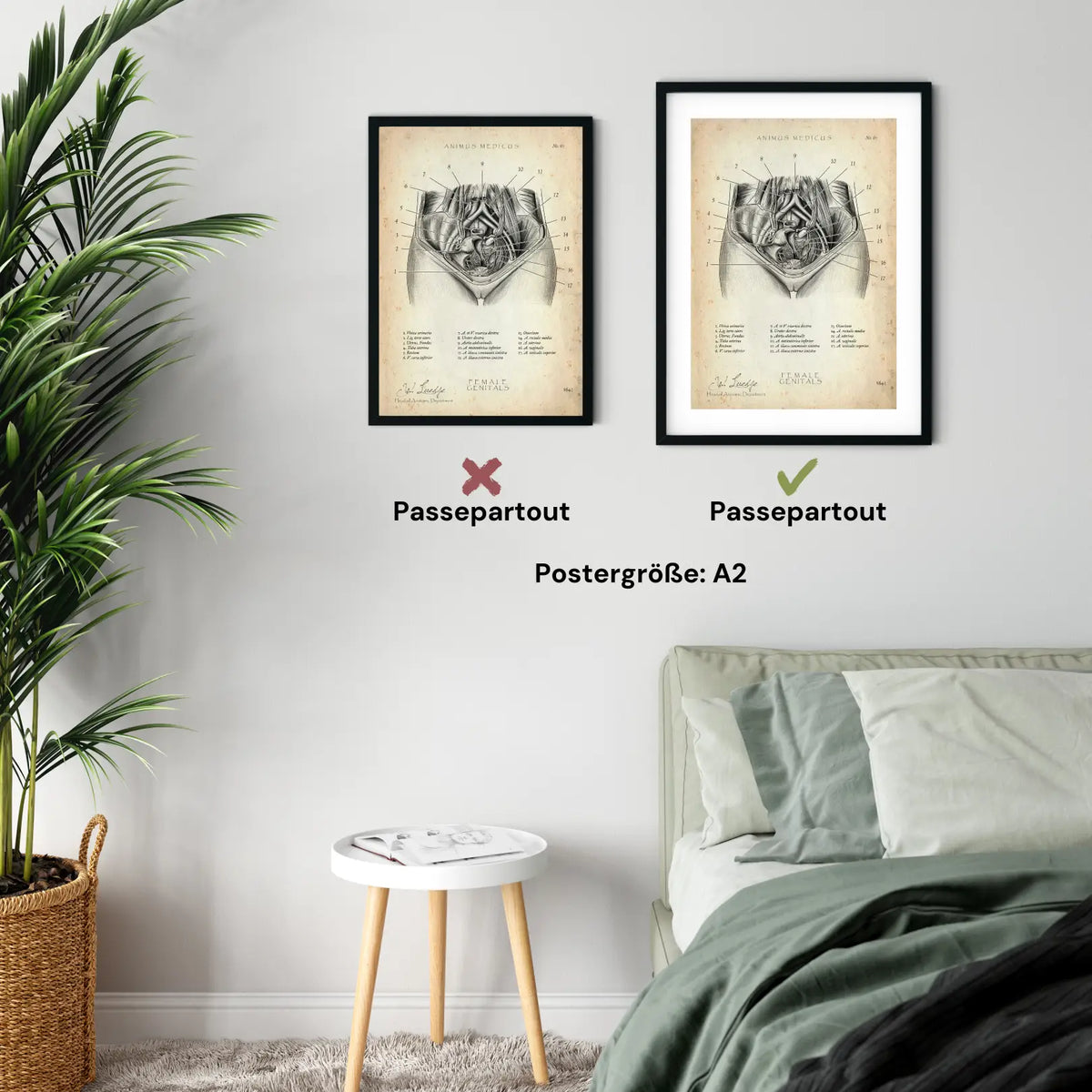 Weibliche Genitalien - Animus Medicus GmbH