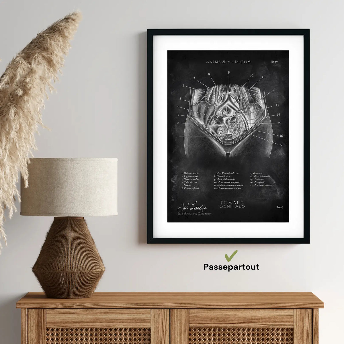 Weibliche Genitalien - Chalkboard - Animus Medicus GmbH