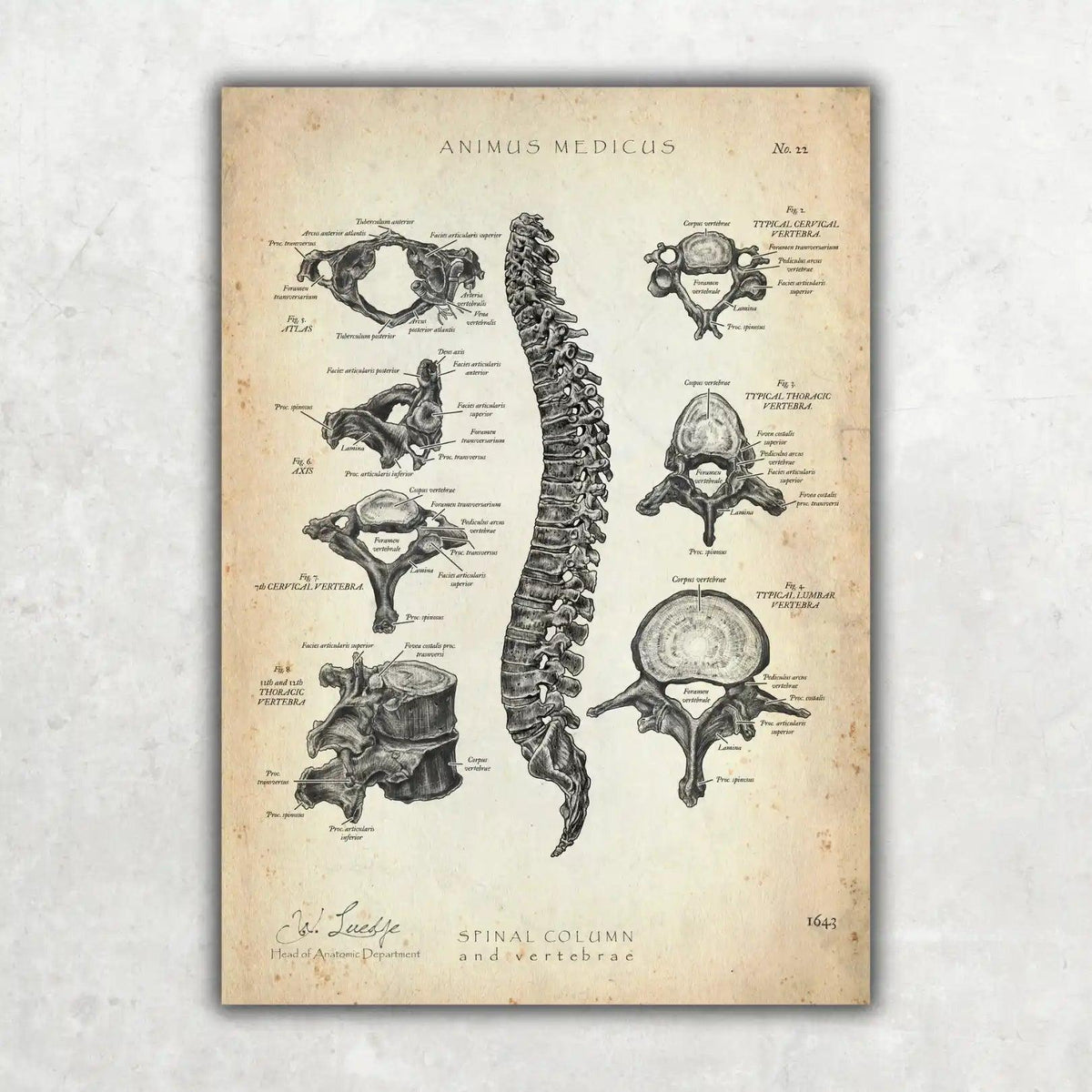 Wirbelkörper Anatomie - Animus Medicus GmbH