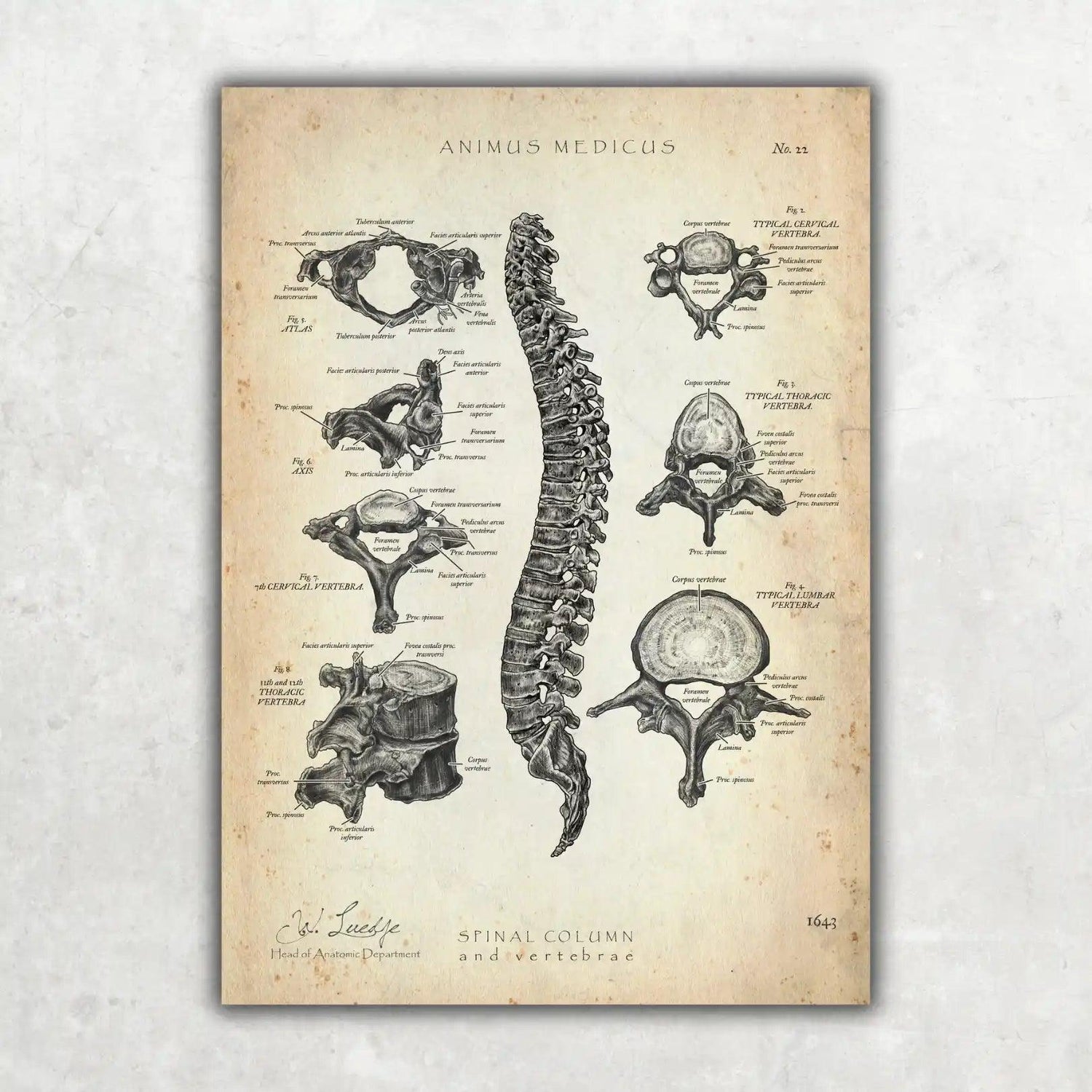 Wirbelkörper Anatomie - Animus Medicus GmbH