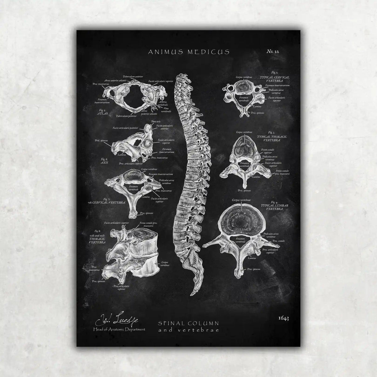 Wirbelkörper Anatomie - Chalkboard - Animus Medicus GmbH
