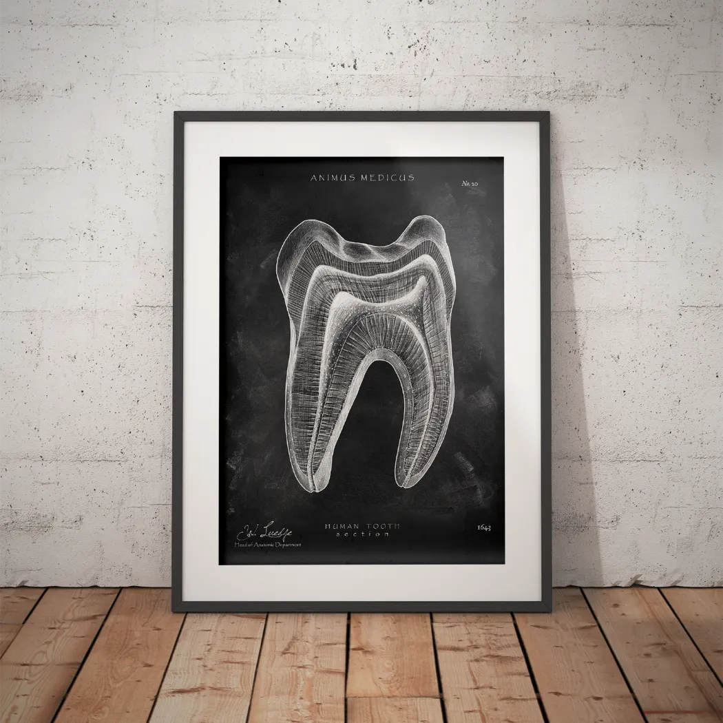 Zahn Anatomie im Querschnitt - Chalkboard - Animus Medicus GmbH