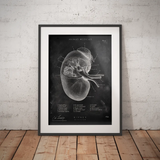 Anatomie des reins - Tableau noir
