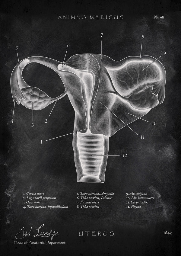 Uterus mit Adnexe - Chalkboard