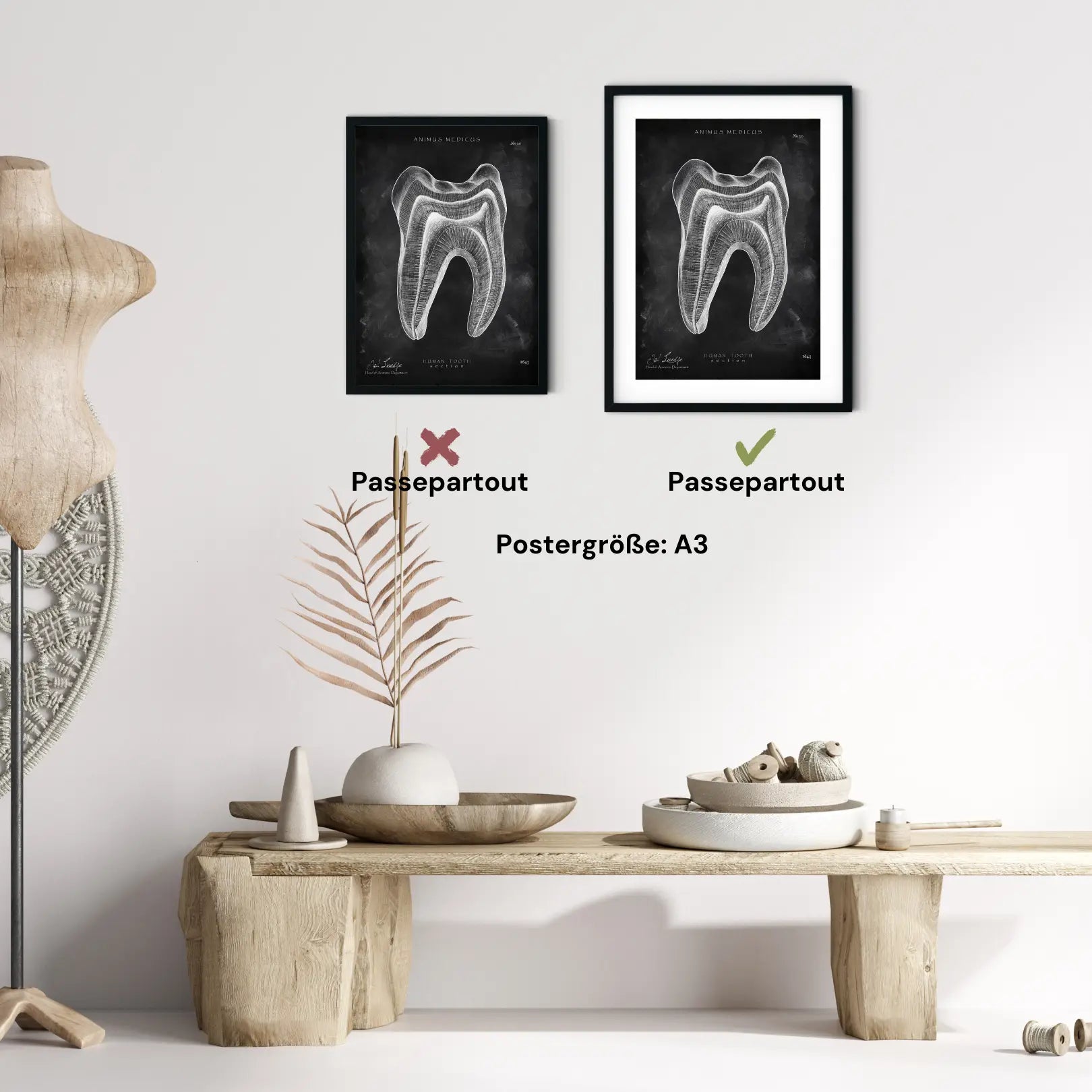 Anatomie dentaire en coupe transversale - tableau