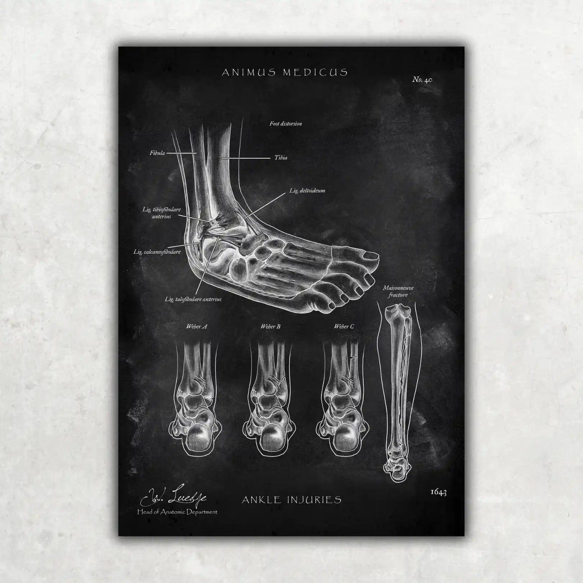 Fuß Anatomie Sammlung - Chalkboard - Animus Medicus GmbH