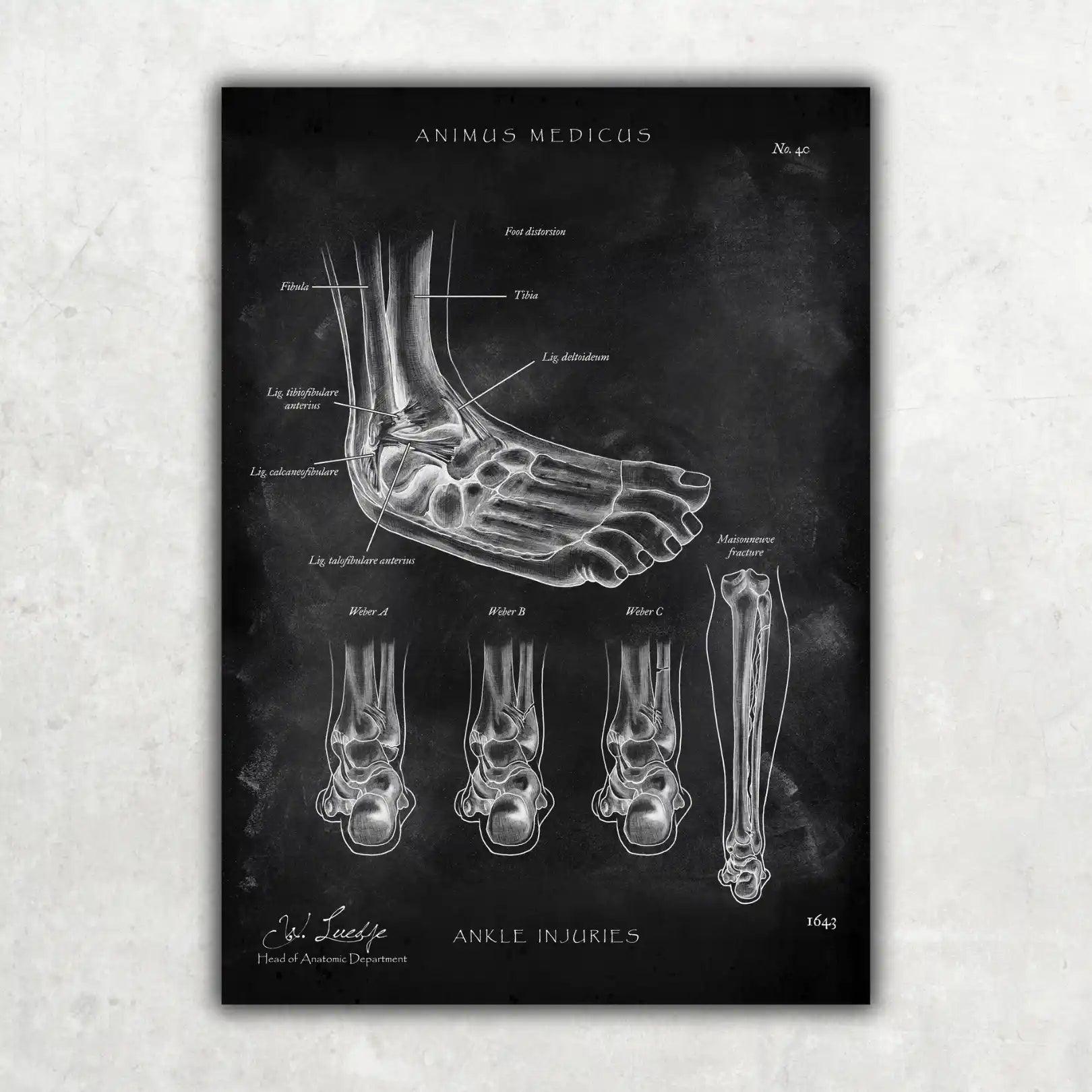 Fuß Anatomie Sammlung - Chalkboard - Animus Medicus GmbH