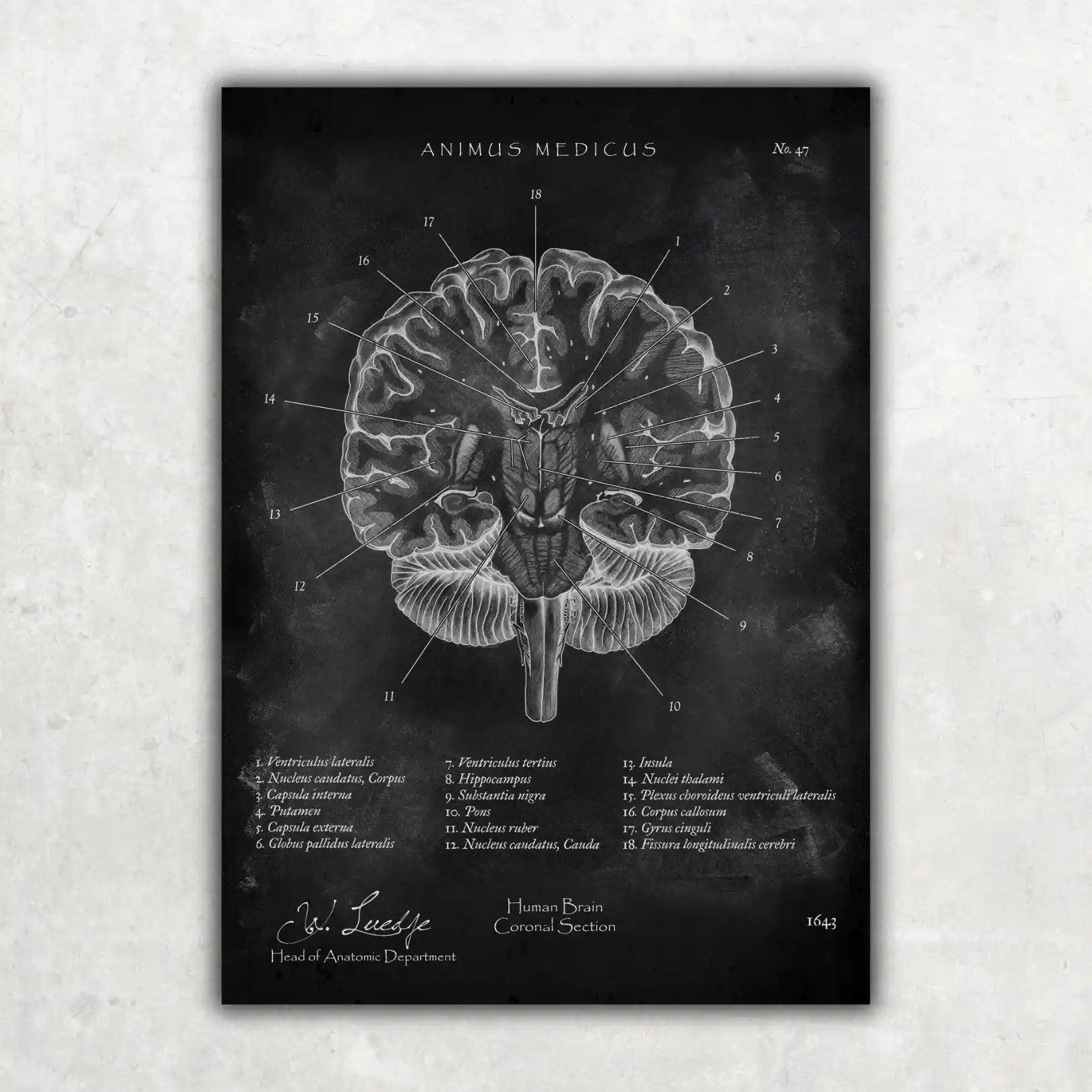 Gehirn Aufbau im Schnitt - Chalkboard - Animus Medicus GmbH