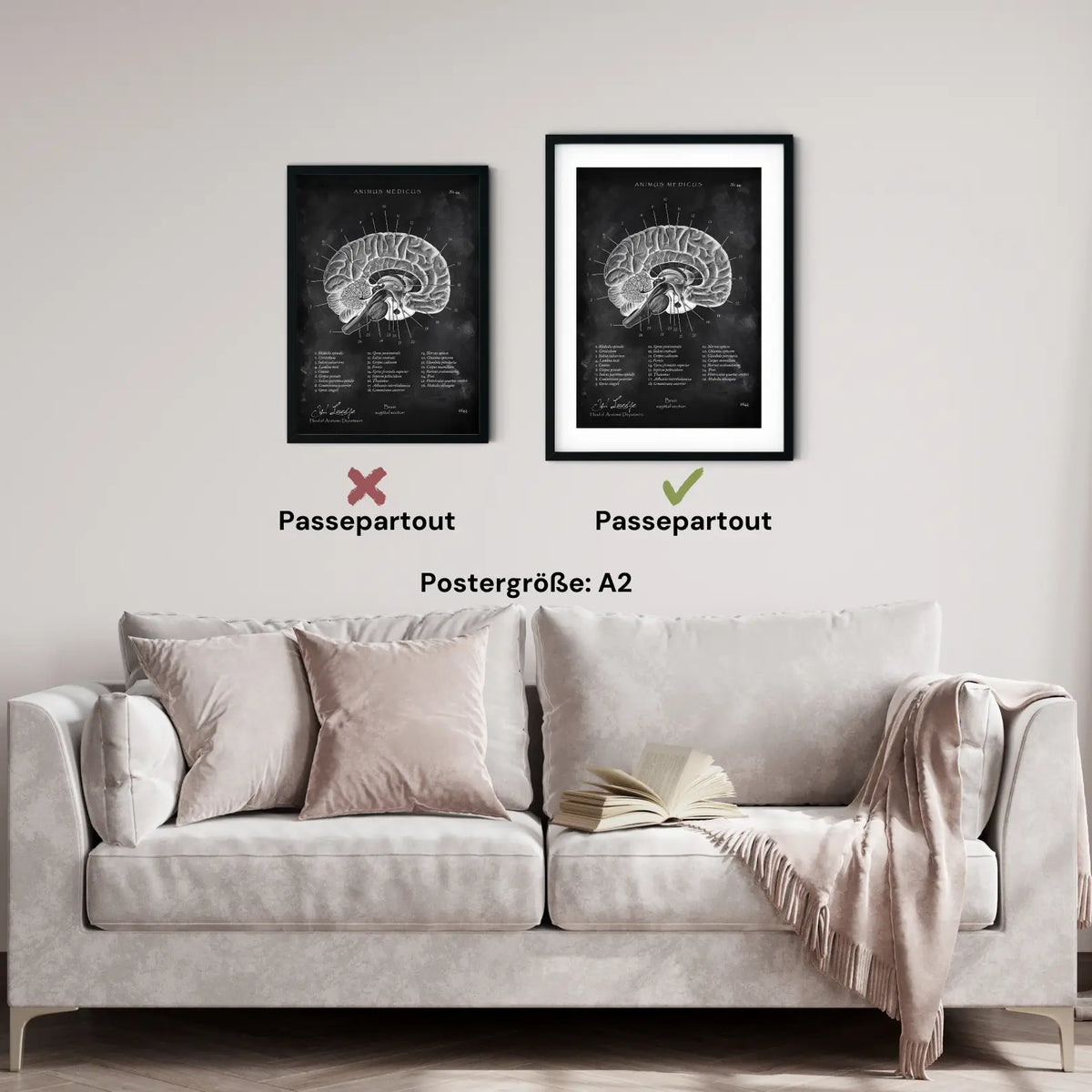 Gehirn im Sagittalschnitt - Chalkboard - Animus Medicus GmbH