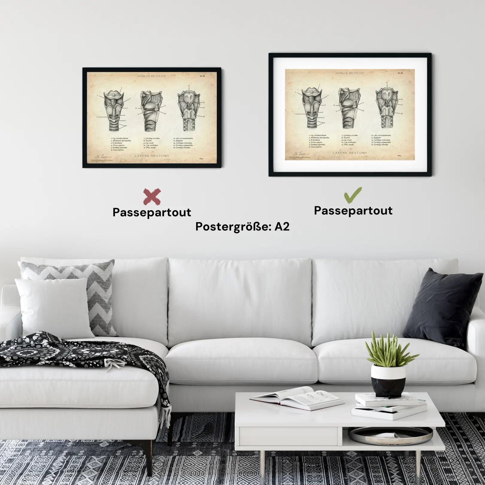 Kehlkopf Anatomie - Animus Medicus GmbH