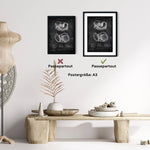 Leber Anatomie - Chalkboard - Animus Medicus GmbH