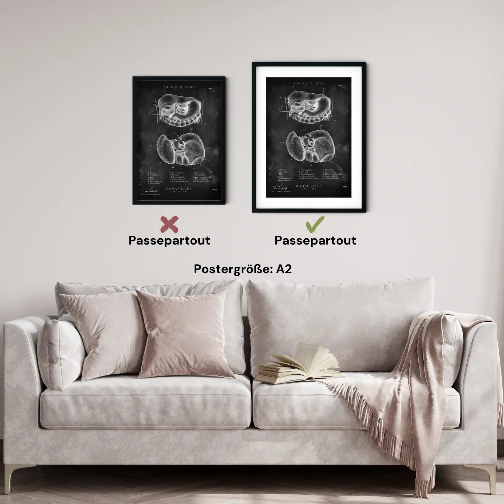 Leber Anatomie - Chalkboard - Animus Medicus GmbH