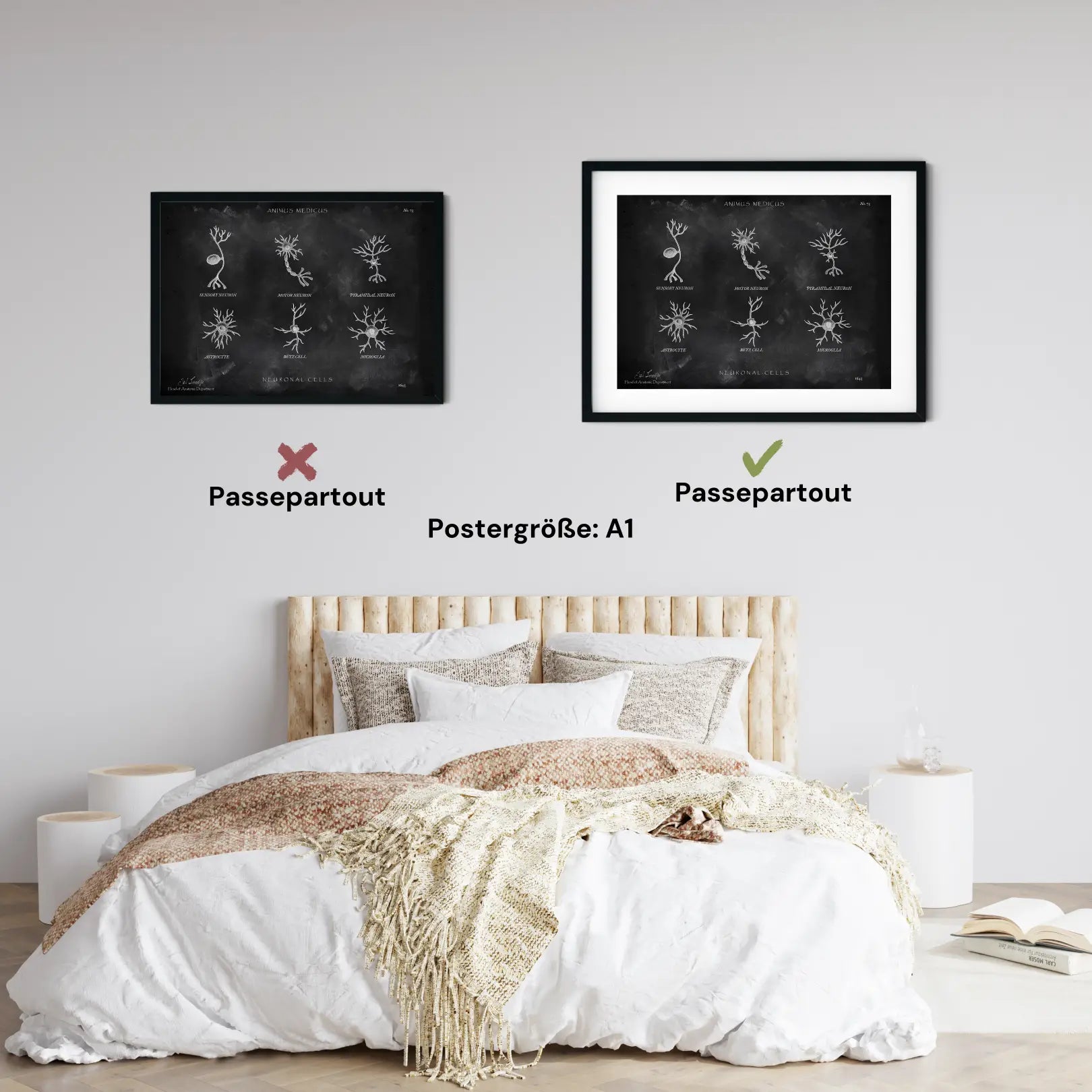 Neuronale Zellen - Chalkboard - Animus Medicus GmbH