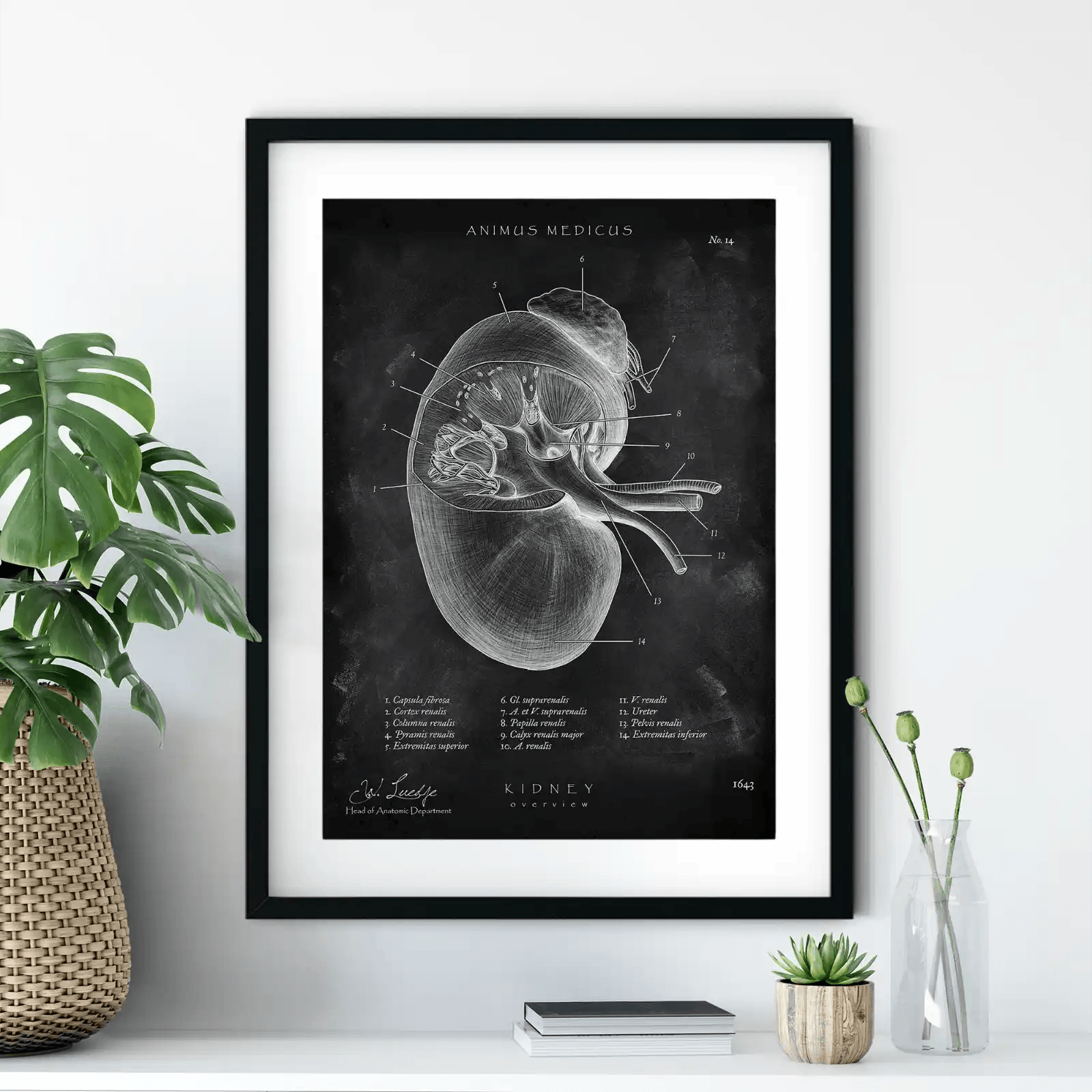 Nieren Anatomie - Chalkboard - Animus Medicus GmbH