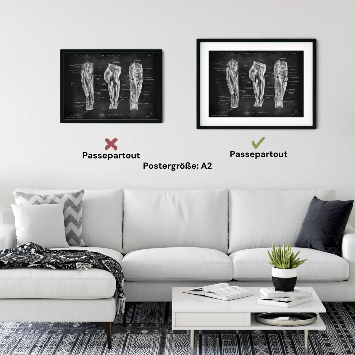 Oberschenkel Muskeln - Chalkboard - Animus Medicus GmbH