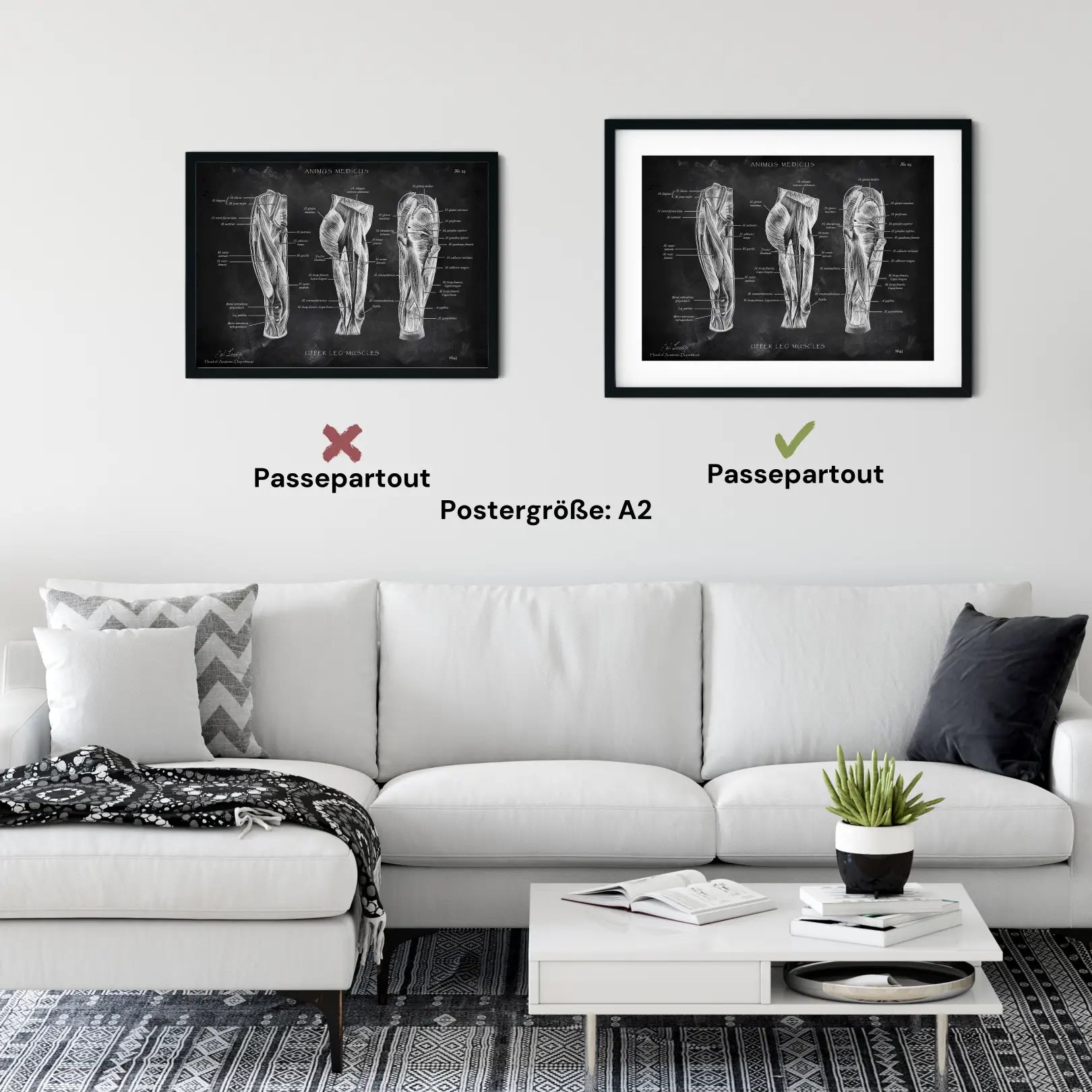 Oberschenkel Muskeln - Chalkboard - Animus Medicus GmbH