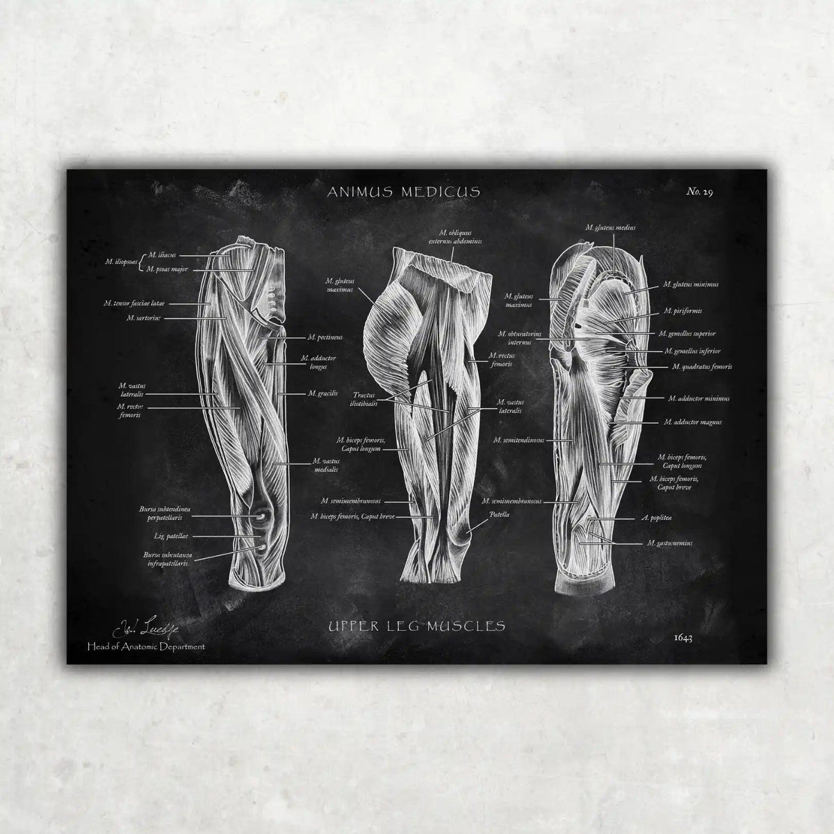 Oberschenkel Muskeln - Chalkboard - Animus Medicus GmbH