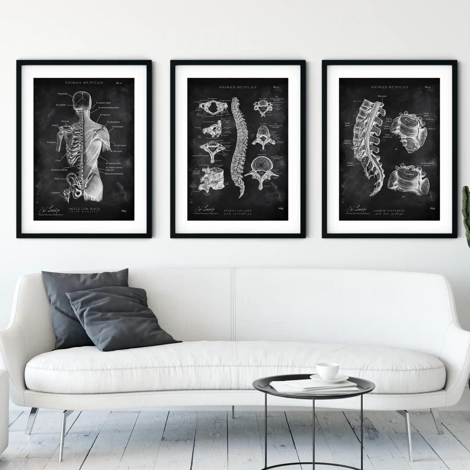 Rücken Anatomie Sammlung - Chalkboard - Animus Medicus GmbH