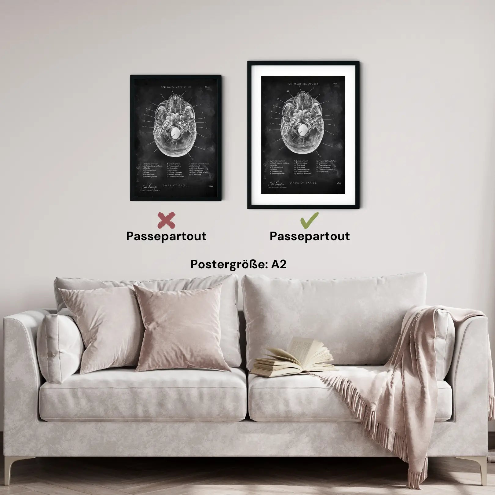 Schädelbasis Anatomie - Chalkboard - Animus Medicus GmbH