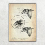 Schulter Impingement - Animus Medicus GmbH