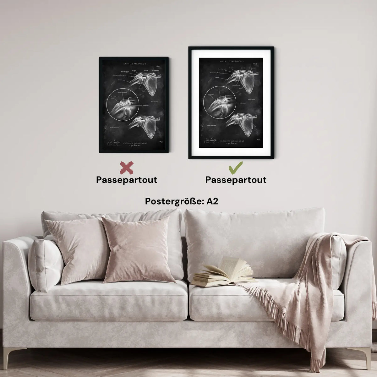Schulter Impingement - Chalkboard - Animus Medicus GmbH