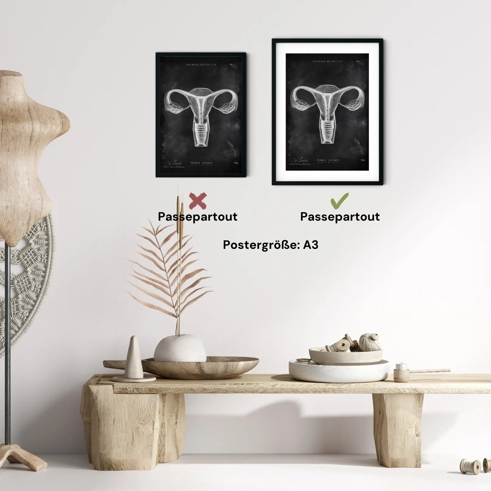 Uterus Anatomie - Chalkboard - Animus Medicus GmbH