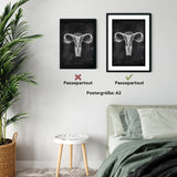 Uterus Anatomie - Chalkboard - Animus Medicus GmbH