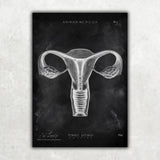 Uterus Anatomie - Chalkboard - Animus Medicus GmbH