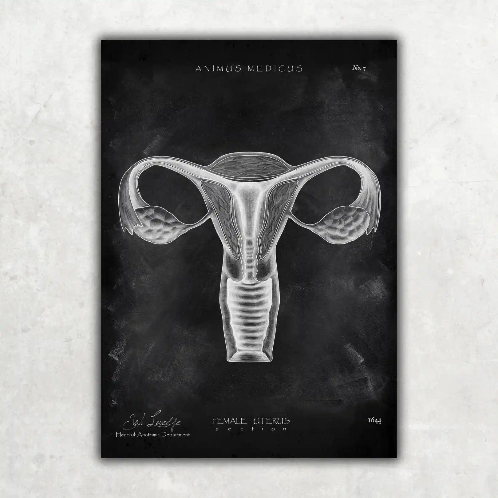 Uterus Anatomie - Chalkboard - Animus Medicus GmbH