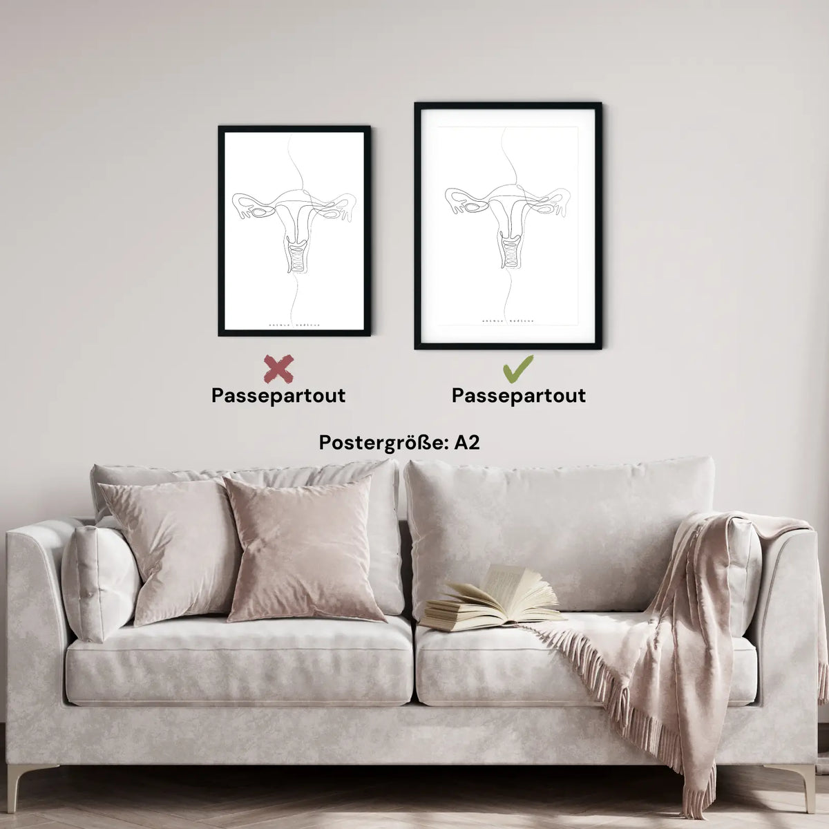 Uterus Anatomie Minimalist - Animus Medicus GmbH
